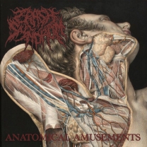 CRASH SYNDROM - MCD - Anatomical Amusements