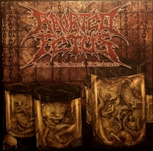 ABORTED FETUS - CD - Fetal Embalmed Existence