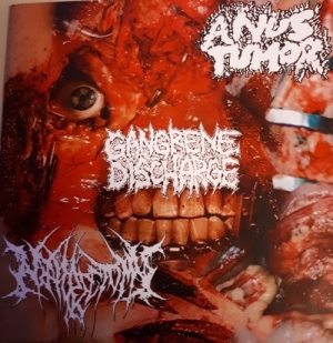 ANUS TUMOR / NEPHRECTOMY / GANGRENE DISCHARGE - 3 way split CD -