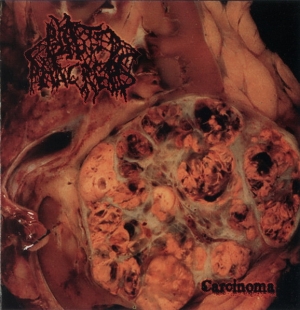 BLASTED PANCREAS - 12'' LP - Carcinoma