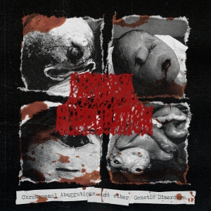 CEREBRAL SUPPURATION - CD - Chromosomal Aberrations and other Genetic Disorders