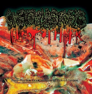 CYSTOBLASTOSIS - CD - Post-Mortem Examination Of Putrid Corpse