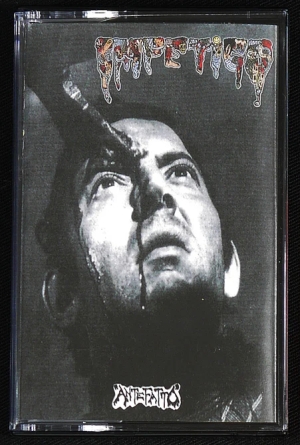 IMPETIGO - Tape MC - Antefatto / Giallo