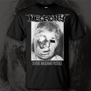 NECRONY - Severe Malignant Pustule - T-Shirt size XL