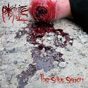PORIFICE - CD - Post​-​Sepsis Syndrome