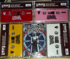 PULMONARY FIBROSIS - Tape MC - Pulmonologists