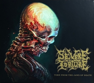 SEVERE TORTURE - CD - Torn From The Jaws Of Death