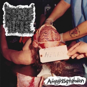 SPASTIC TUMOR - CD - Autopsy Exploitation