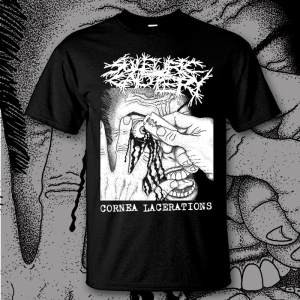 SULFURIC CAUTERY - Cornea Lacerations - T-Shirt size XXL