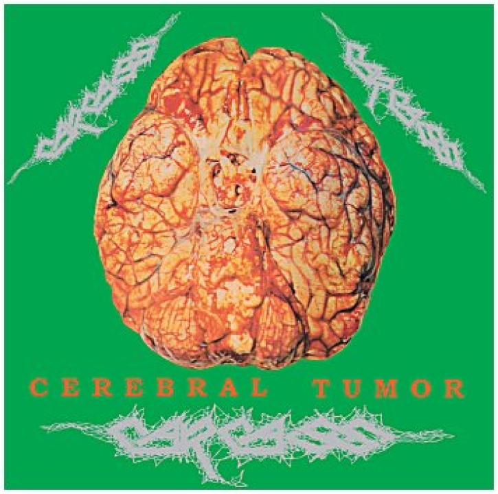 CARCASS - 12'' 2LP - Cerebral tumor - Live in Dortmund, Germany, 30.07.90