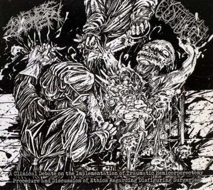 CYSTGURGLE / SULFURIC CAUTERY - Digipak split CD -