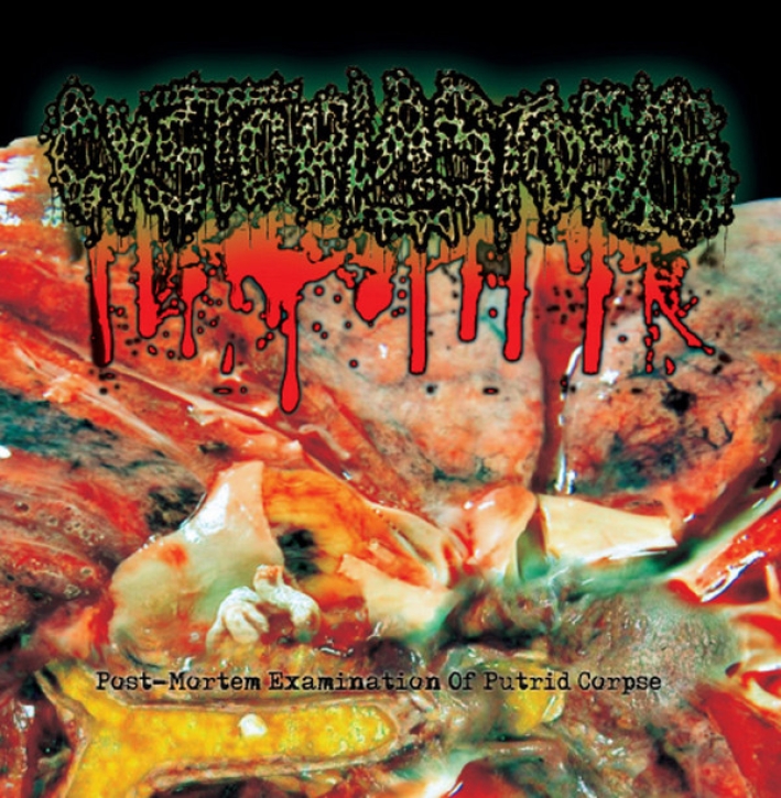 CYSTOBLASTOSIS - CD - Post-Mortem Examination Of Putrid Corpse