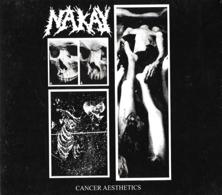 NAK'AY - Digipak CD - Cancer Aestehics