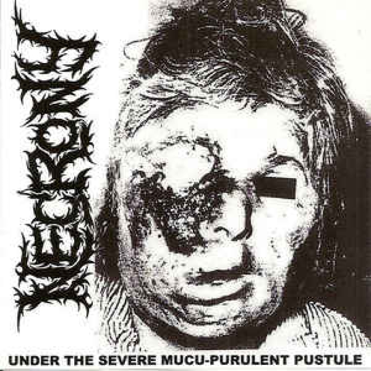 NECRONY - 2-CD - under the severe mucu-purulent pustule
