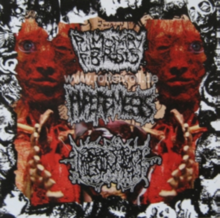 HYPEREMESIS / PULMONARY FIBROSIS / HIPERMENORREA -CD- 3 Way Split