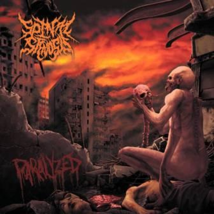 SPINAL STENOSIS - CD - Paralyzed