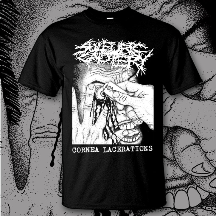 SULFURIC CAUTERY - Cornea Lacerations - T-Shirt size XXL